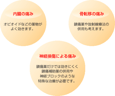 複雑ながんの痛みは、大きく3つに分けられます。